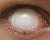 Hellsing white eyes