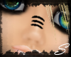 *S*black nose staples
