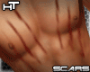 Scar Body