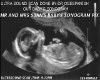 ULTRASOUND SCAN