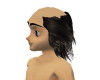 My Balding Hair