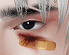 🅰 Bandaid M