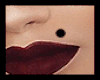 Beauty spot /mole