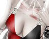 𝜗𝜚 bruises