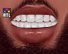 †. M Teeth 183