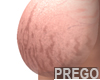 Belly Add Stretchmarks