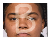 B| Young M.A MH