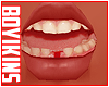 ☀. Kid Teeth 04