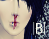|B|Nose Bleed M
