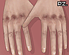 rz. Injured Hands
