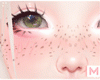 HD Freckles