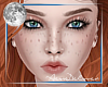 |AD| Freckled Minnie