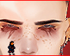 Lalande brows