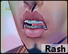 .:. Dental Braces