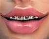 Smile For Braces