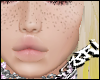 light freckles q x p