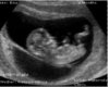 Haysha Ultrasound
