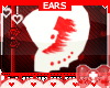 Medi Angel * Ears V3