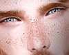 XâºFrecklesâ RD