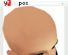 Bald Male