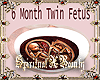 6 Month Twins In Tummy