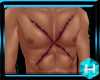 ℋ. Anyskin Chest Scar