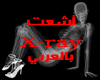 X - ray