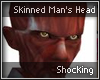 Skinned Man's head