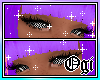 Checkerboard Sclera ❖