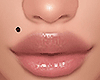 D| Mole Right Cheek