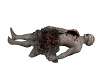 Plague Victim