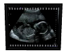 ~B~Basic Ultra-Sound Scn