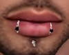 Lower Lip Snake Bites
