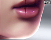 金 Fight Nose