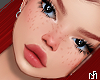 Kiza T1 + Freckles