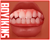 ☀. Kid Teeth 11
