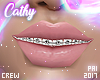 ♥ Cathy Braces