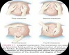 Pregnacie Examination