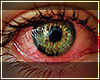 Weed Eyes