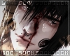𝒔. dead center II