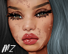 Santy Vitiligo T4