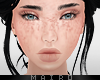 M̶. Freckled Me.