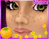 [xNx] N! Pinky Freckles