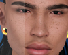 😜FRECKLE LIGHTSKIN MH