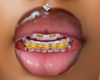 YLLW braces