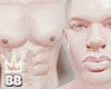 Albino Skin
