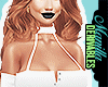 ! Choker Mini Dress