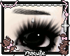 worried brow