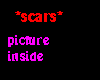 *scars* CSI Sidle