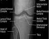 xray